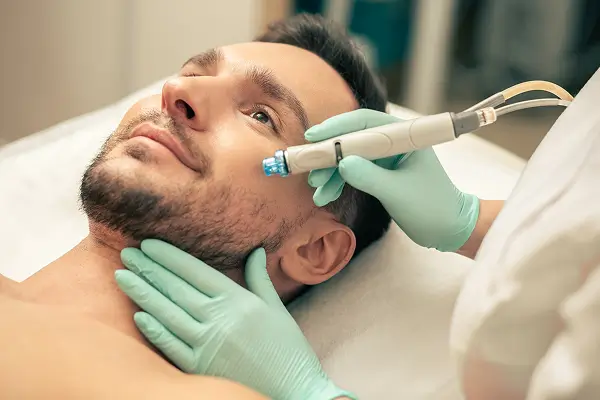 Acid peel